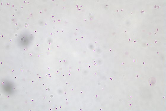 Akkermansia muciniphila AKK016 100 Billion CFU/g Vegan/Allergen Free/Gluten Free/Dairy Free