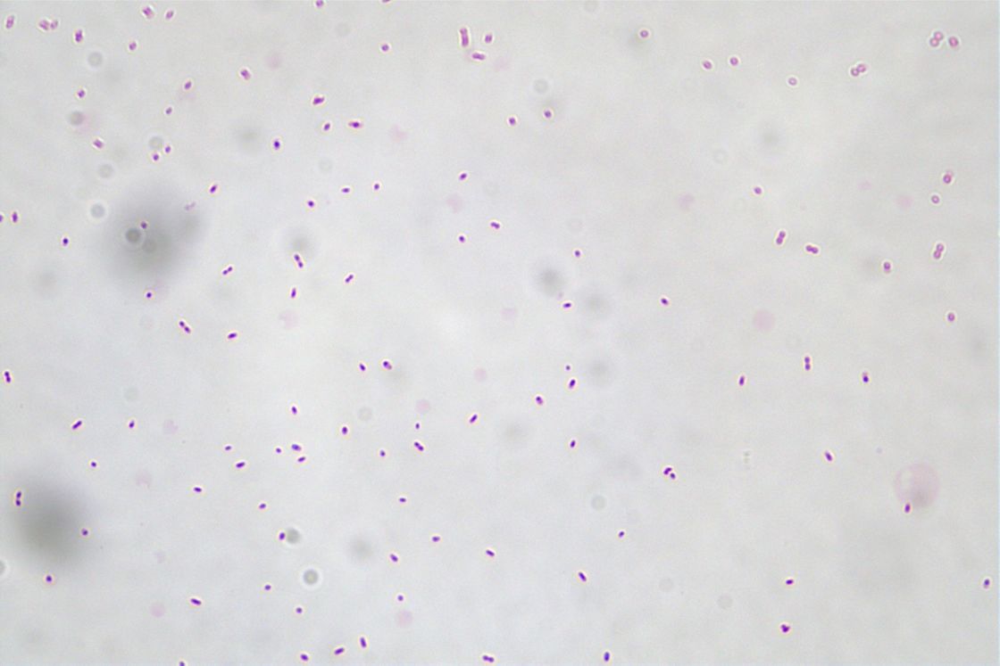 Akkermansia muciniphila AKK016 100 Billion CFU/g Vegan/Allergen Free/Gluten Free/Dairy Free